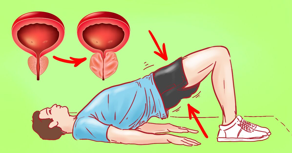 Esercizi terapeutici per prostatite cronica