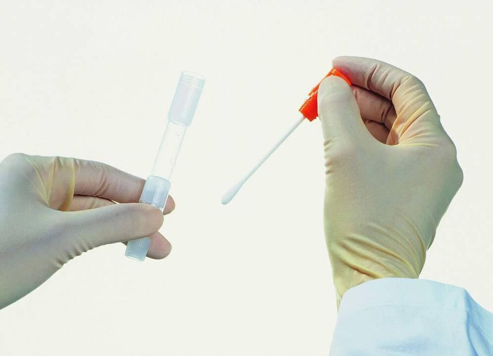 Raccolta di analisi per rilevare la prostatite cronica